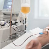 La aféresis terapéutica es un procedimiento médico avanzado que se estudia por su potencial impacto en inflamación, salud inmunológica y envejecimiento biológico.